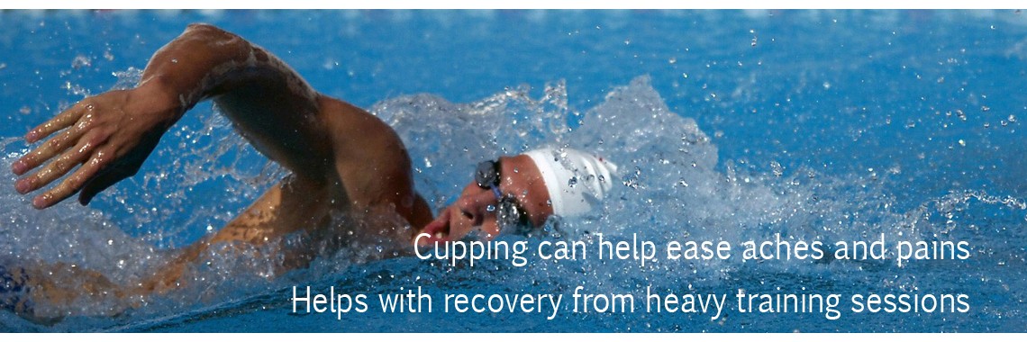CuppingSwimmers